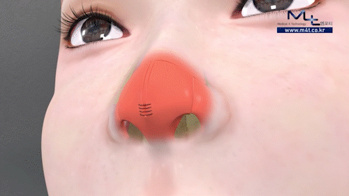 ���� GIF �ִϸ��̼�